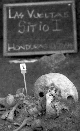 skeletons