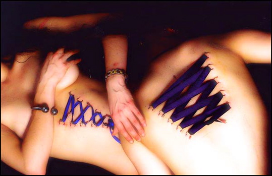 bme-corset_sm (76k image)