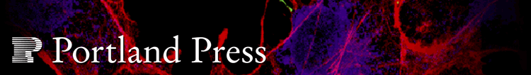 Subcellular location of PKCalphaII-GFP (green) in Green Monkey COS-7 cells using laser scanning confocal microscopy two days after transfection. The actin cytoskeleton is stained with Texas Red-phalloidin and the endoplasmic reticulum (purple) identified with an antibody to calreticulin.   By Lorene Langeberg, Scott Lab Manager at the Howard Hughes Medical Institute, Portland, OR.